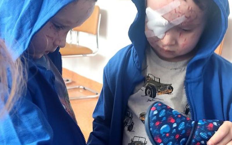 Timur i Nazar w Klinice Okulistyki Ogólnej SPSK 1