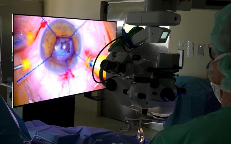 Prof. Robert Rejdak podczas jednej z operacji w Kiinice Okulistyki Ogólnej SPSK 1 (fot. A. Guzowska)