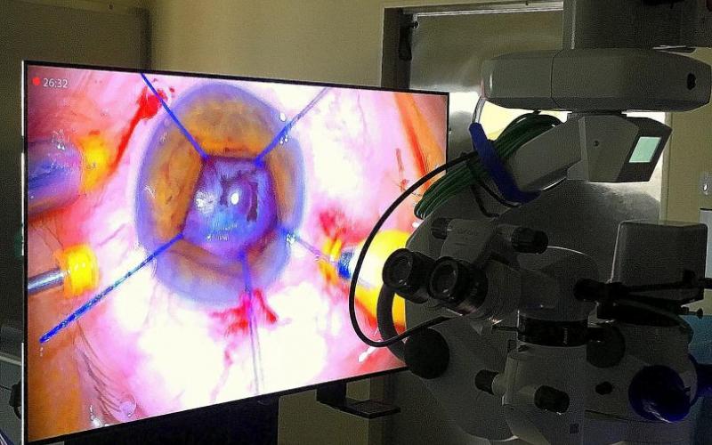 projekt okulistyka dziecięca (fot. Anna Guzowska)